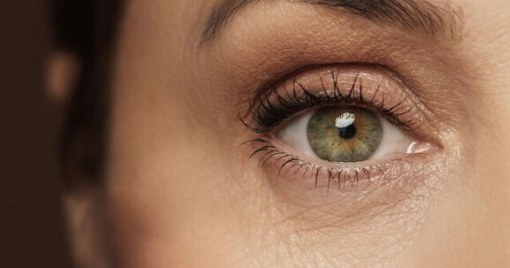 Benefits of a blepharoplasty