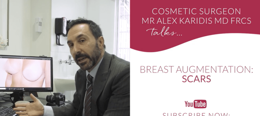 Breast augmentation-scarring