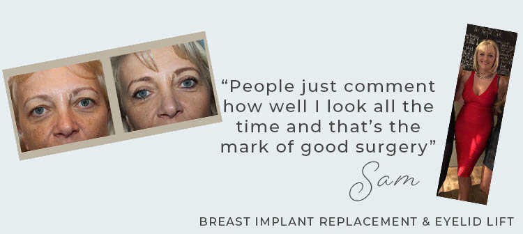 Breast implant replacement and eyelid lift combo cosmetic surgery
