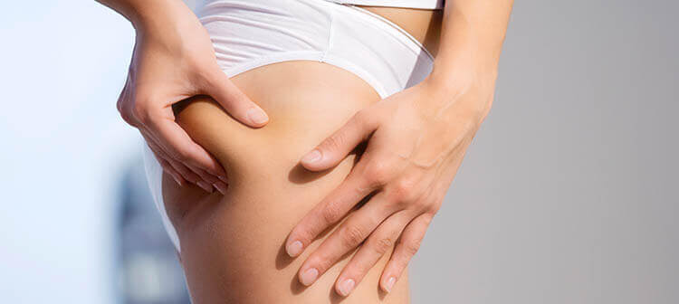 Cellulite Treatments