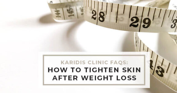 How to tighten skin after weight loss naturally