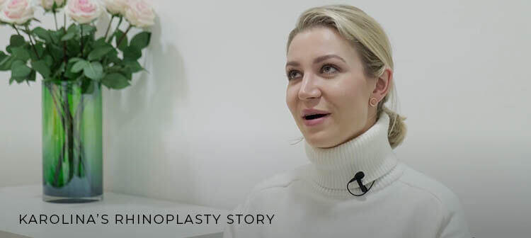 Karolina's rhinoplasty story