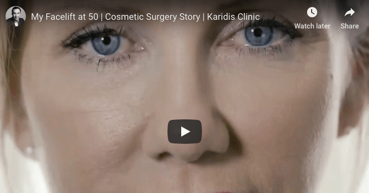 My Facelift at 50 Journey | Karidis Clinic Real Life