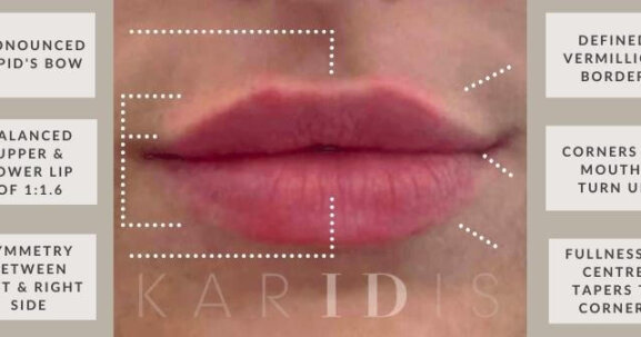 Natural Lip Augmentation Results