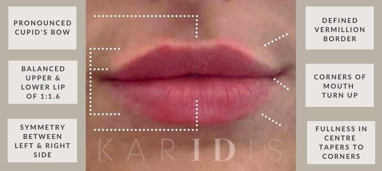 Natural Lip Augmentation Results