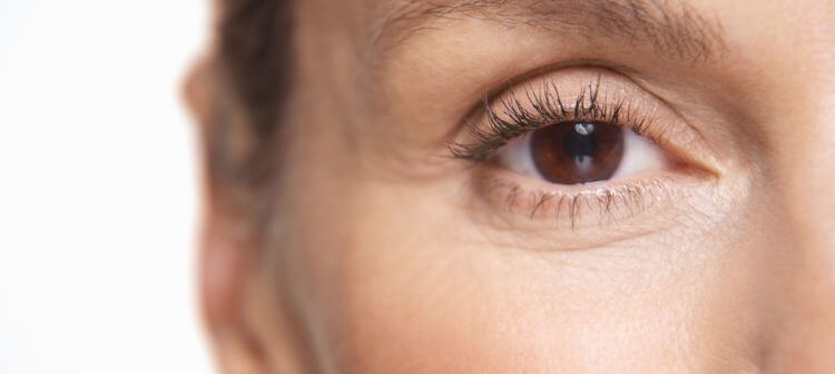 idea age for blepharoplasty